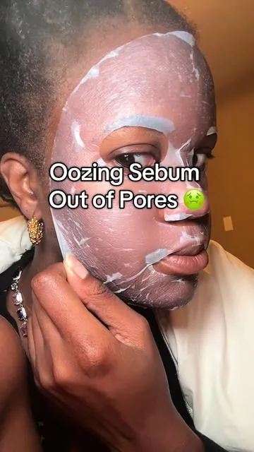Acne-prone skin this mask is for you! All of that came out of my pores 😳 #medicube #hypochlorousacidmask #acneproneskin #skincareroutine #kbeautyskincare 