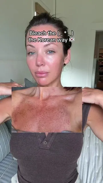 it’s a laser… but DIY and make it Korean 🇰🇷 #drmelaxin #hyperpigmentation #GlowUp 