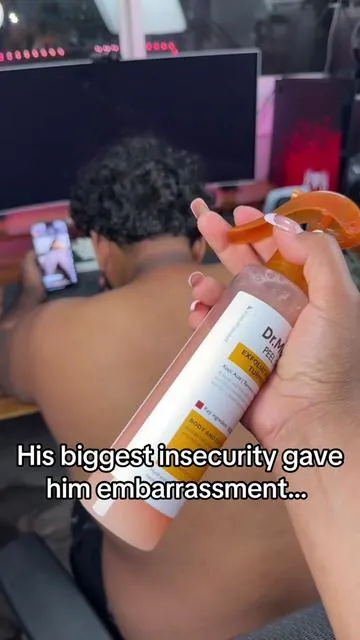 I love the way his neck is clearing up😍#dealsforyoudays #shippedbytiktok #summervibes #drmelaxin #tiktokshopcreatorpicks 