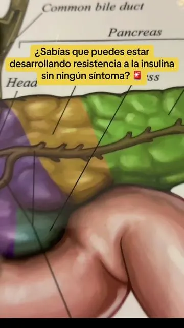 ¿Sabías que puedes estar desarrollando resistencia a la insulina sin saberlo? Sin dolor. Sin síntoma obvio. Pero las señales están ahí — bajón post-comida, antojos, peso que no baja, grasa abdominal. 🚨 Como NP: la resistencia a la insulina es silenciosa y abre la puerta a la prediabetes y diabetes tipo 2. Vivonu Blood Sugar Complex — Berberina (AMPK = Metformina) + Hoja de Morera + Melón Amargo + Canela + Fenogreco + Cúrcuma. 20 ingredientes. 80 días. Vegano. Non-GMO. Habla con tu médico si tomas medicamentos. Para quien quiere actuar antes de que duela. El producto que YO uso 👇 --- #resistenciainsulinica #azucar #tiktokshopcreatorpicks #creatorsearchinsights #dealsforyoudays  