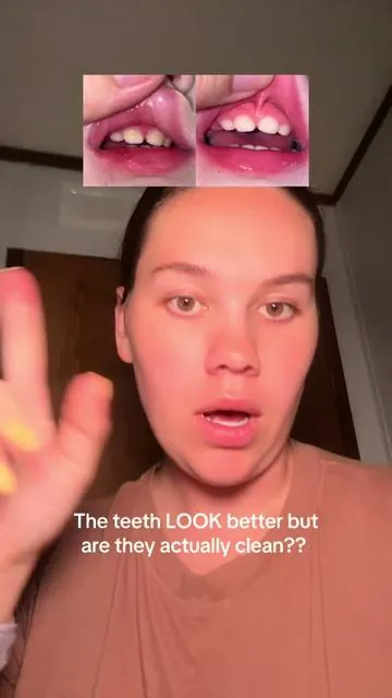 Needless to say, IT WORKS 🦷 #kidstoothpaste #nobstoothpaste #nobsjr #oralcare #oralhygiene 