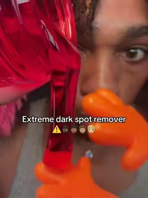 Why is nobody talking about this? Using astaxanthin on dark spots is next level 