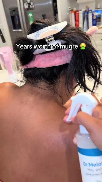 @Dr.Melaxin #korenskincare 