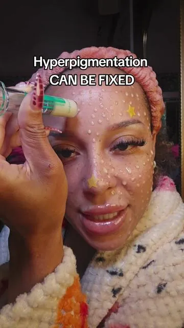 ofc they wont  #creatorsearchinsights #hyperpigmentation #melasma #darkspots #melaninskincare 