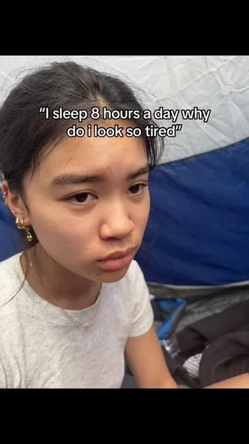 I’m so shocked with this ngl
#eyebags #darkcircles 