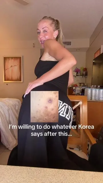 What’s the best that could happen??… THIS. #D#DrMelaxinR#RadiantBlowoutRoutineH#HyperpigmentationK#KeratosisPilarisMatureSkinCare 