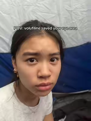 Wow my eyebags were so bad #eyebags #darkcircles 