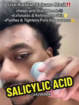 Salicylic Acid does wonders😭🙏