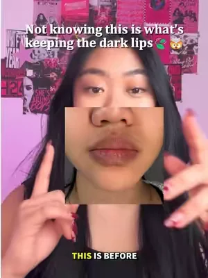 A week in, my lips got lighter. Friends asked what lipstick I switched to. I said: literally nothing🤣#dealsforyoudays #lipserum #darklips #beautytips #drleo 