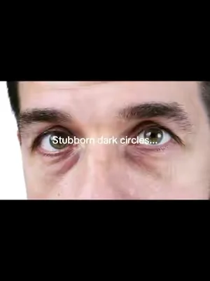 @The Ordinary #tiktokmademebuyit #viral 