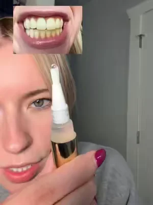 Wish I would’ve done this years ago #yellowteeth #teethwhitening #whiteningteeth #snowteethwhitening #snowwhiteningpen @Snow Teeth Whitening 