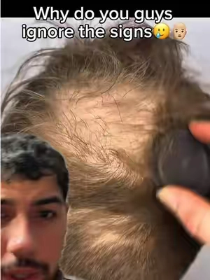 Look into a better shampoo. PLEASE👨🏼‍🦲🧬