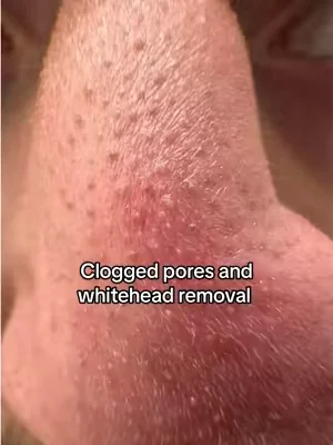 Only skincare I use anymore...