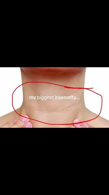 who else doom scrolls a bit too much 😭😭 this has literally been a life saver 🥹🫶🏼💗 medicube pdrn volufiline gua sha neck cream sagging neck jawline tiktok shop #tiktokshopcreatorpicks #tiktokshopsummerturnup #DealsForYouDay #tiktokshopdealsforyou #medicube medicube best neck lifting firming cream volufiline pdrn collagen jawline glass skin buy with coupon maehni @medicube US Store @medicube global 