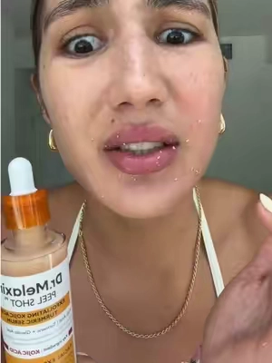 #drmelaxin #peelshot #exfoliation #labiososcuros #tiktokshopcreatorpicks  Anuncio Disclaimer: Basado en mi experiencia personal. Este producto no está destinado a diagnosticar, tratar, curar o prevenir ninguna enfermedad o afección médica. Los resultados pueden variar según el tipo de piel y la rutina. Contenido compartido solo para el cuidado general de la piel y con fines educativos.
