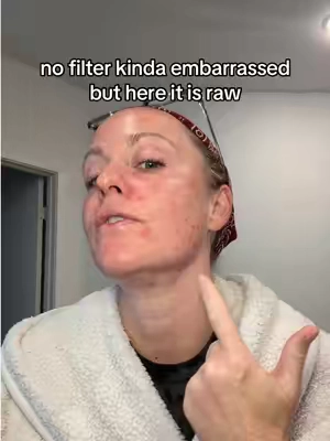 No filter! Don’t come for my skin…

#matureskinmakeup #matureskin #makeuphacks #lazygirlmakeuproutine #tiktokshopcreatorpicks 