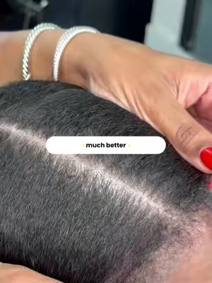 Much better 🤏🏾 The 4-Step Scalp Therapy System makes that scalp go from dry and flaky, to moistured and spotless✨ #scalptok #scalpmassage #scalproutine #scalptok #hairtherapy 
