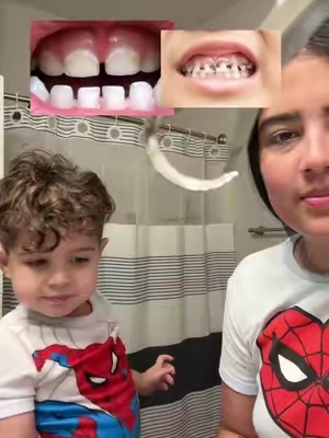 Al final, ellos dependen de nosotros para crear esos hábitos que los van a acompañar toda la vida 😬🦷🪥 #saludbucal #gurunanda #momsortIktoK #KIdsortIKtOK #oralhygiene 