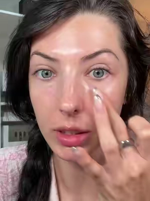 Under eye filler terrifies me 