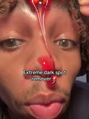 Had I known this ealier…. 