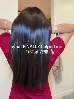 Hair shedding, itchiness, hairline, all in one product. @VT Cosmetics US #vtcosmetics #hairserumbrush #hairhack #scalpcare #tiktokshopcreatorpicks 