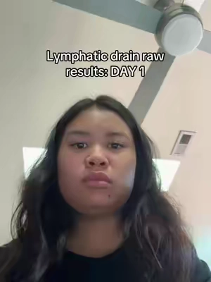 genuinly love it sm now wow
#lymphaticdrainage #GlowUp 