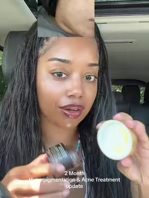 My fav Medicube skincare balls #fyp #skincare #medicube 