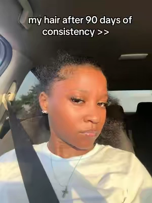 #xyzbca #foryoupage #viralvideo #hairgrowth #hairtok 