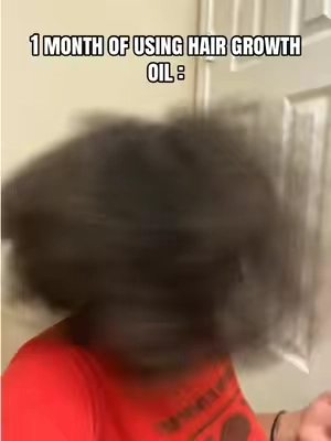 That Rosemary do wonders #hairgrowth #foryou #xyzbca #viralvideo #hairtok 