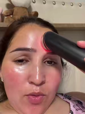 #fyp#skincare 