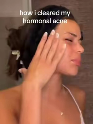 the best skincare product money could buy😫😫 #medicube #skincare #LoveIsland #kayda 
