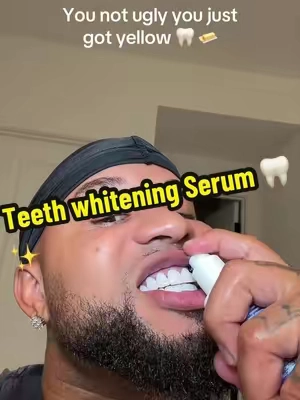 @Hismile US that’s ppl say i got veneers i just 😭 it’s this 🤷🏽‍♂️ #hismile #teethwhitening #teethcleaning #purple #fyp 