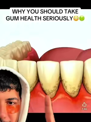 Don’t neglect it, you prob will regret it in the future🤢