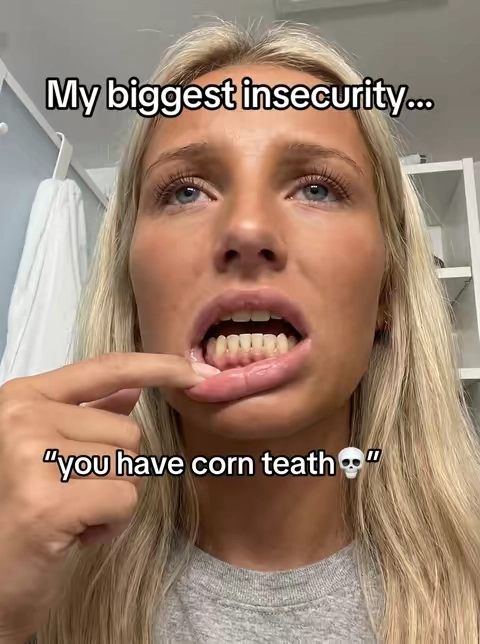 👆#toothpaste #whiteteeth #insecure #falldealsforyou 