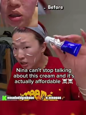 #paircream #pair #acne #nina #skincare 
