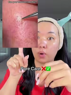 #ilso #porecare #blackhead #ilsosupermeltingsebumsoftner #koreanskincareproducts 