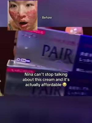 #paircream #ninalin #acne  #nina #skincare