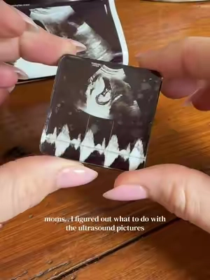 The cutest way to save the very first picture I have of him 🤍 #babyultrasound #keepsake #scrapbooking #expectingmom #babypictures 