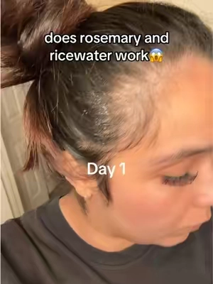 Postpartum shedding, alopecia coming and going… my hair has been through it. This is one thing I’ve stayed consistent with because I truly have faith in it. Everyone’s results are different, but these are mine. Watch until the end for Day 27. ❤️

#HairLoss #hairtok #RosemaryRiceWater
#hairtransformation #postpartumhairloss 