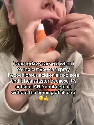 i swear i use this hypochlorous acid for EVERYTHING 😂  #ingrownhair #shavingbumps #ingrownhairs #bfrelatable #couplegoals      