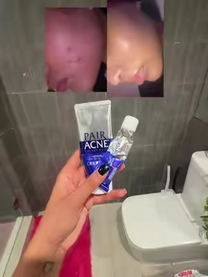 #glassskin 