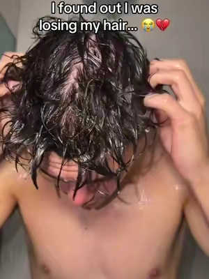 Caught it before it got bad… #hims #hairgrowth #hairthinning #hairloss 