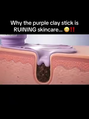 It pulls everything out of your pores… 😳 #skintific #skinresurfacing #porecleansing 