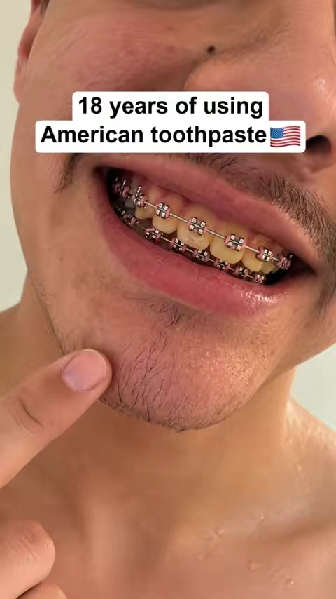 7686741655277358367