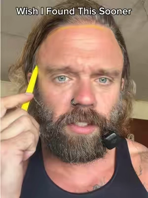 So rare to come across something that actually works… @medicube US Store #hairloss ##hairgrowthtips 