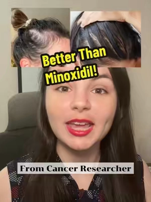 Saw palmetto is commonly associated with men’s health, but it’s also being studied for hair support in both men and women. 🌿 One reason is its potential influence on DHT, a hormone that can contribute to follicle miniaturization in androgen-related hair thinning. By supporting healthy DHT activity around the hair follicle, saw palmetto may help support thicker-looking hair, stronger follicles, and healthy hair growth over time. An interesting botanical for anyone noticing their hair becoming thinner or less full with age! ✨ #sawpalmetto #hairgrowth #thinninghair #hairhealth #womenover40