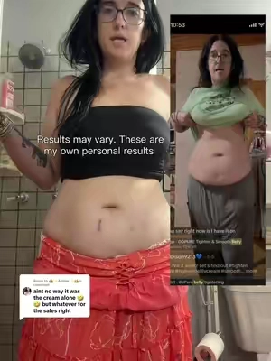 Replying to @👑✨️Amber✨️👑 the results speak for themselves. The belly is still there. No weight lost. Just tightened skin. @Gopure #gopure #gopurebellyfirmingcream #bellyfirmingcream #fyp 