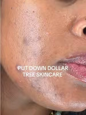 #medicube #medicubeskincare #hyperpigmentation #darkspots @medicube US Store 