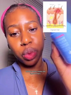 #stitch with @Ki_getbands in grown hairs shaving. This had 3 actives, AHA, PHA and BHA that prevent in grown hairs, by exfoliating dead skin that’s clogging your pores and forcing the hair to curl back into your skin. Prep the skin to help prevent in grown hairs, razor bumps and burns.