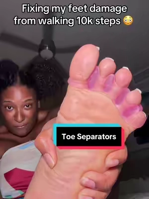 I wish I knew this sooner than later 😳 #toeseparators #plantarfasciitis #10ksteps #footcare #footpain 